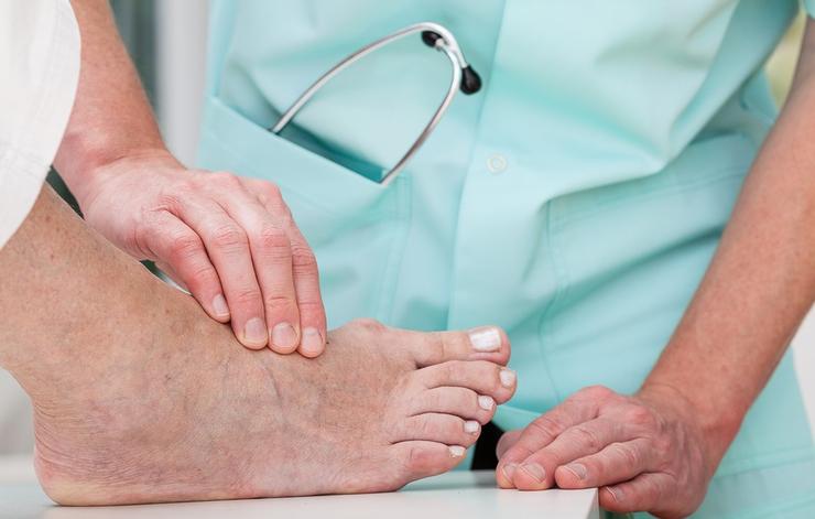 Why do Doctors Keep this Simple Recipe away from the Public? Here’s how to get rid of Bunions Completely Natural