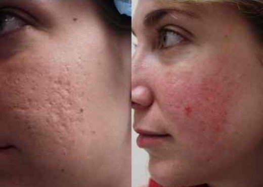 Images for This homemade scar removal cream is …