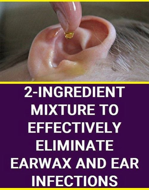 THESE 2 INGREDIENTS CAN ELIMINATE EARWAX & EAR INFECTION